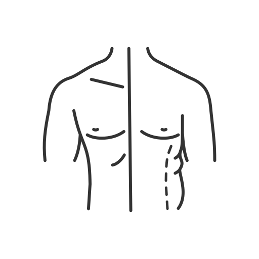 Coolsculpting